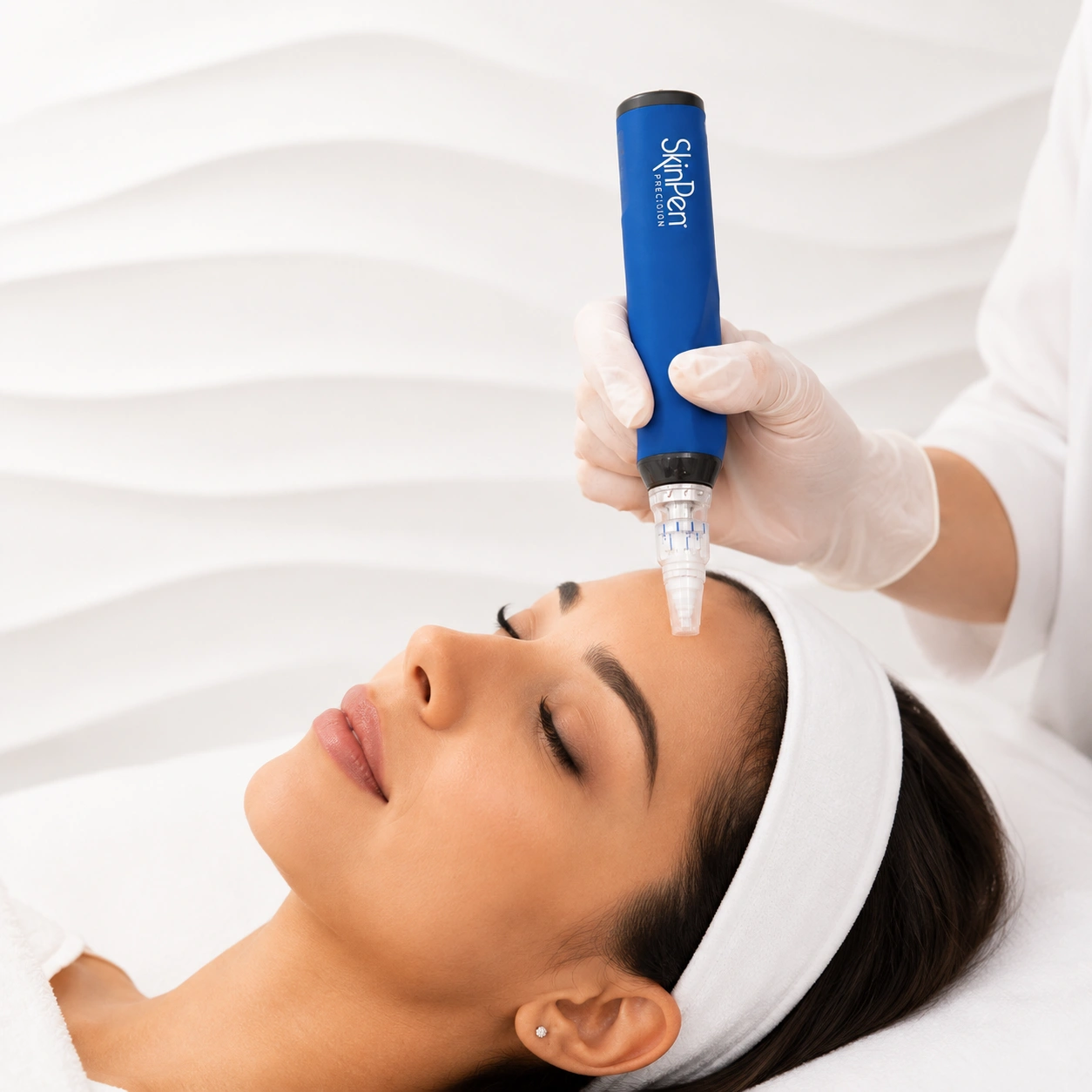 SKINPEN® MICRONEEDLING2